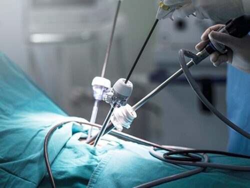 Symptoms After Endometrial Biopsy